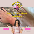 Load image into Gallery viewer, Jelly-Smack Bite and Sting Relief - 2 Bottles
